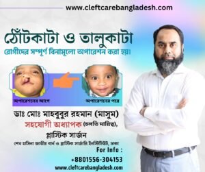 Plastic Surgeon in Bangladesh Mahbubur Rahman 4